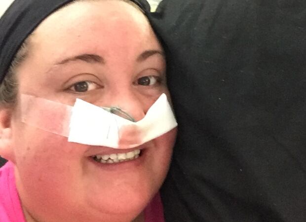 Cushing's Disease was also an emotional rollercoaster for Natalie. Photo / Press People