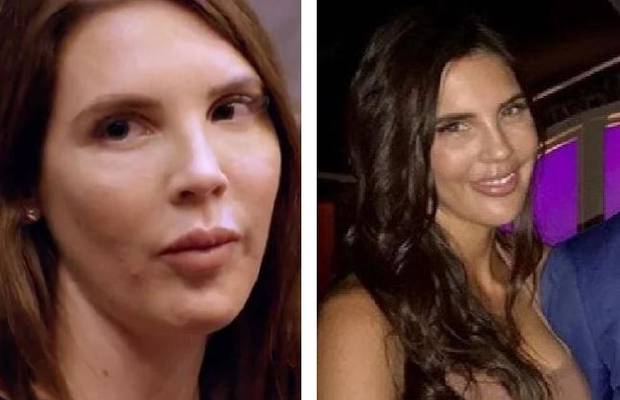 Tracey before and after she had her fillers disolved. Photo / News.com.au