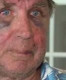 Rod Pilling, 63, was set upon after asking a group on a Perth train to tone down their swearing. Photo / 7 News