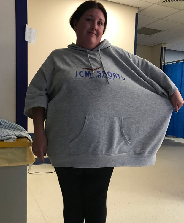 Natalie shows just how much weight she has gained and lost again. Photo / Press People