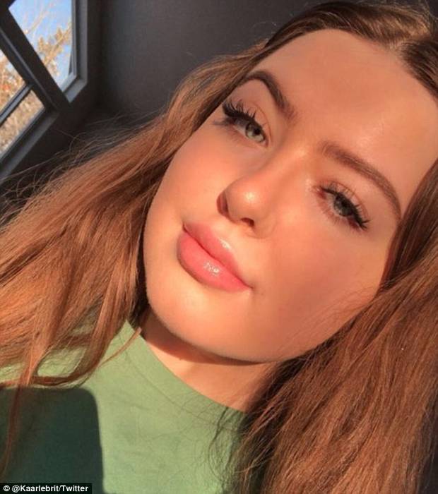 It took Kaarle two years to finally clear her skin of pimples. Photo / Twitter