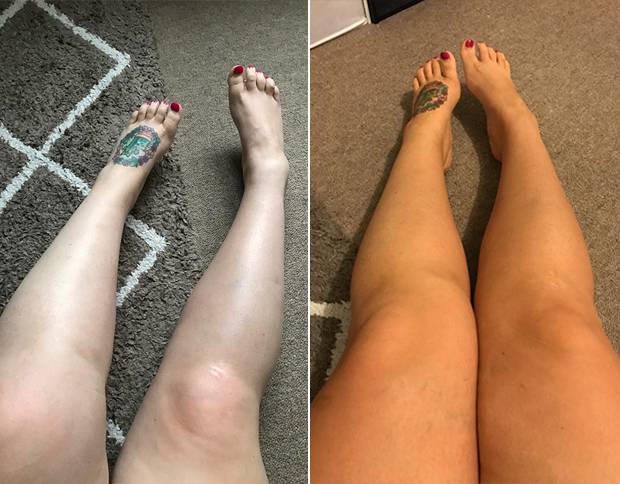 Liana's before and after (the next morning). 