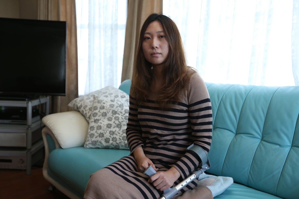 Woman needed surgery for burns caused by moxibustion