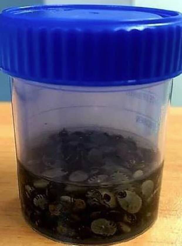 Roughly 511 paralysis ticks were pulled from the poor python. Photo / Supplied