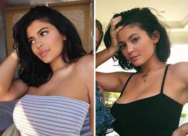 Plastic Surgeon Reveals The Secret Behind Kylie Jenner S Shrinking Lips