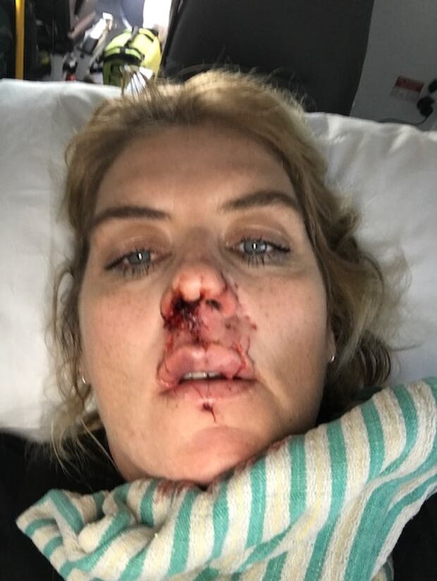 Waikato dog lover in shock after dog bites her face in 