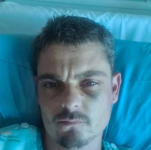 Poull Anderson (JayJay Feeny 's brother) in hospital in Auckland 09 March 2022 recovering from shotgun wounds sustained during an altercation in central Auckland 05 March 2022 picture supplied