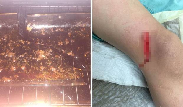 The dish involved and the nasty gash on six-year-old Tyler Hansen's right leg. Photos / Supplied 
