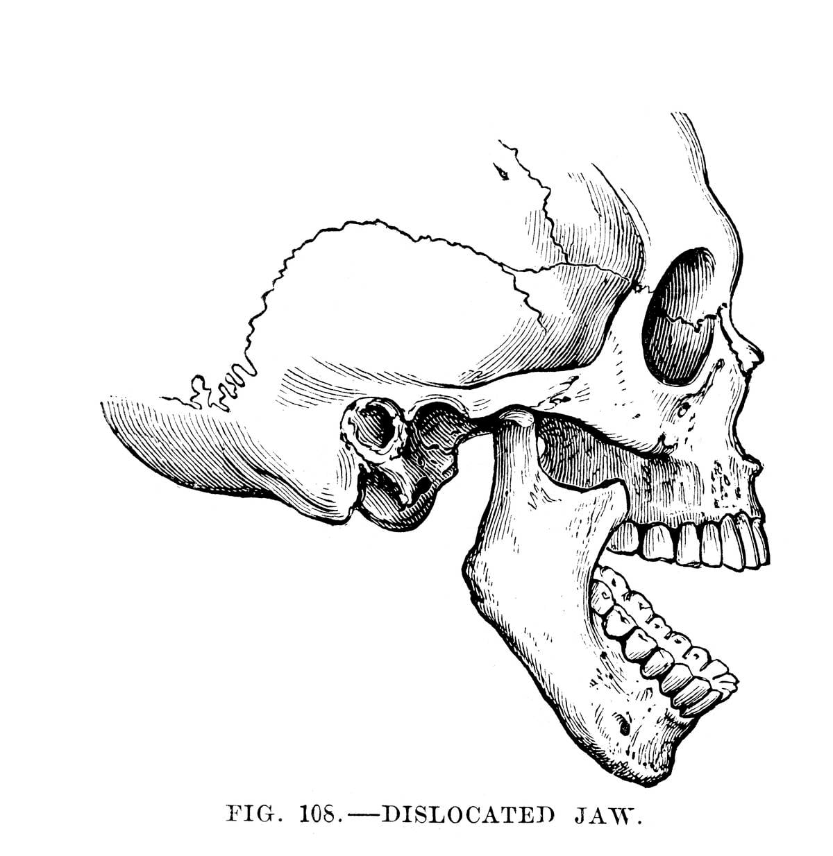 Jaw Problems Often Due To Ligament Damage Nz Herald