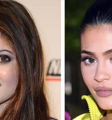 The Secret Behind Kylie Jenner S Shrinking Lips Nz Herald