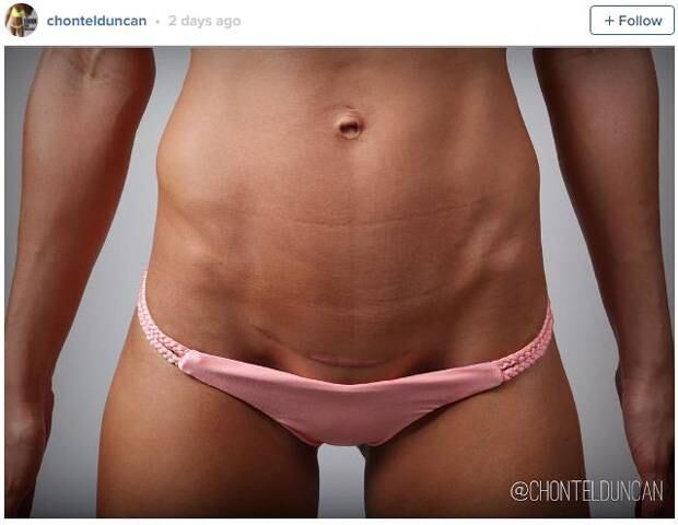 Chontel Duncan My Six Pack Caused Serious Labour