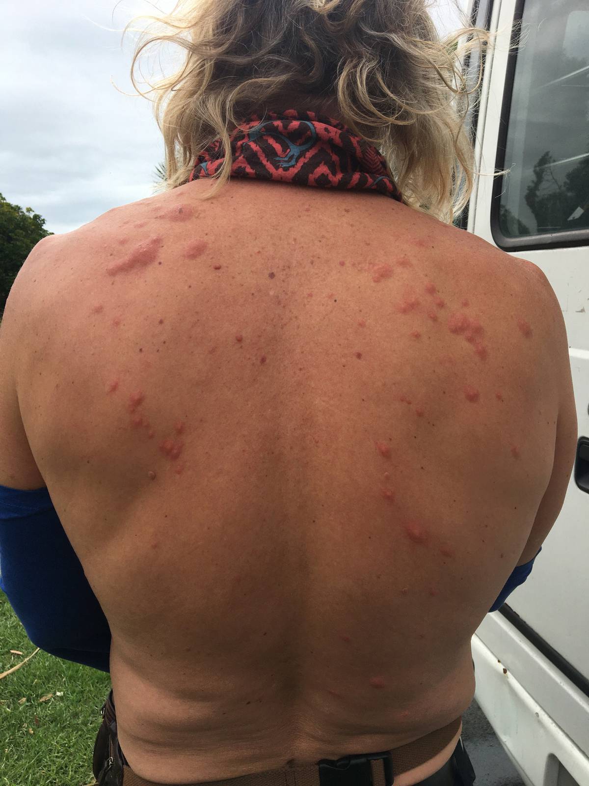 Auckland Motel Blamed For Bed Bug Bites Gets All Clear From Pest