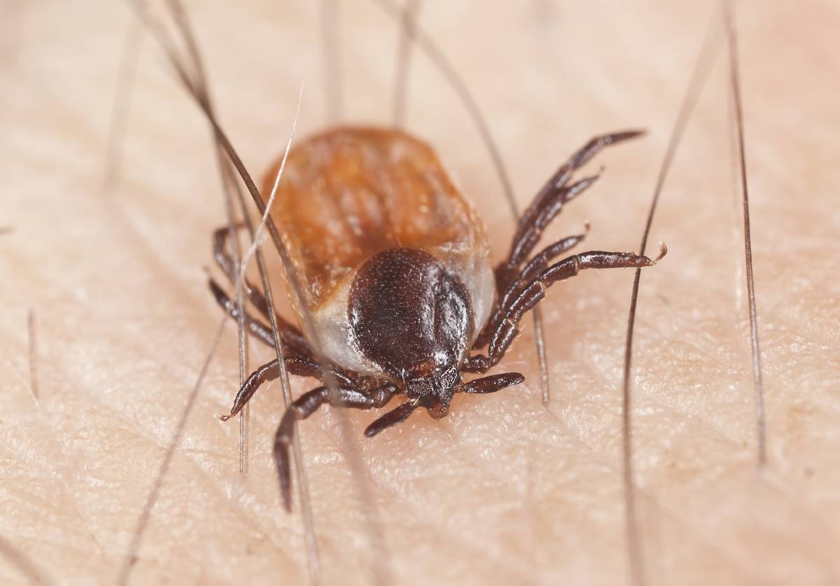 Lyme Disease A Ticking Time Bomb Nz Herald