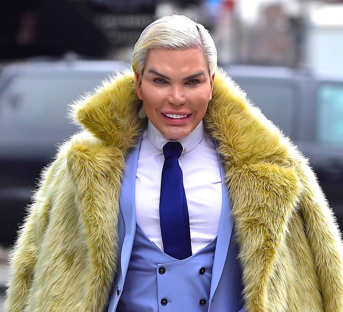 Human Ken Doll Unrecognisable After 1 Million In Plastic Surgery Nz Herald