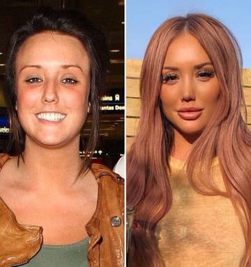 Get Wallpaper Reality Star S Changing Face After Plastic Surgery Nz Herald HD