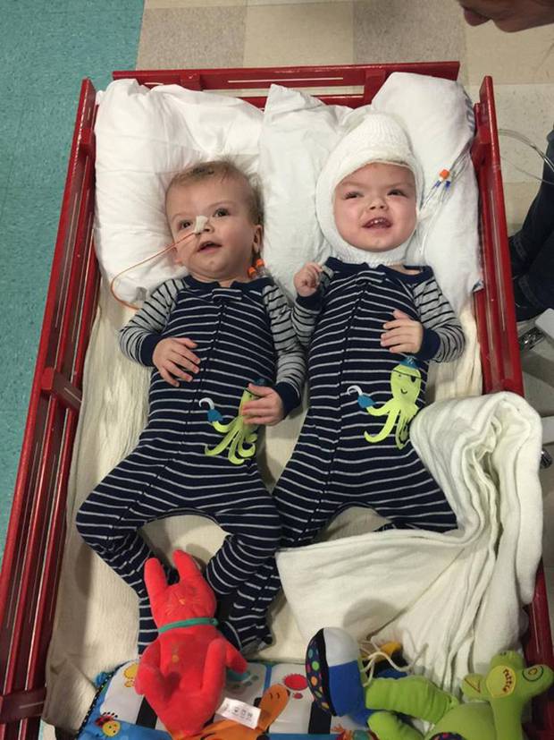 Conjoined twins, Jadon and Anias McDonald, bond after surgery NZ Herald