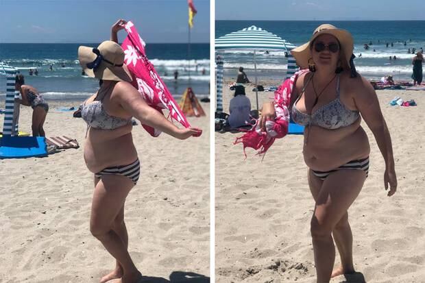 Shelly Proebstel said that for a split-second after the incident she thought about covering up, but then reminded herself about what she learnt from her journey. Photo / Bald and Beautiful Facebook 