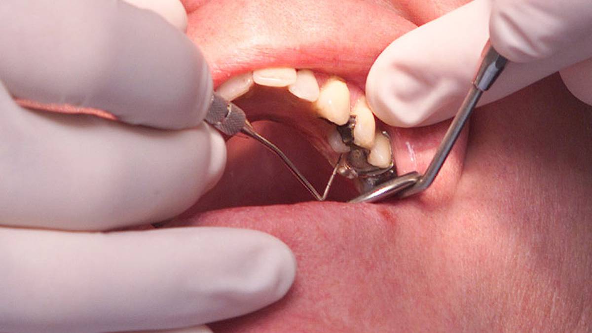 Christchurch mum left with bleeding gums, holes in teeth as dental costs take a toll