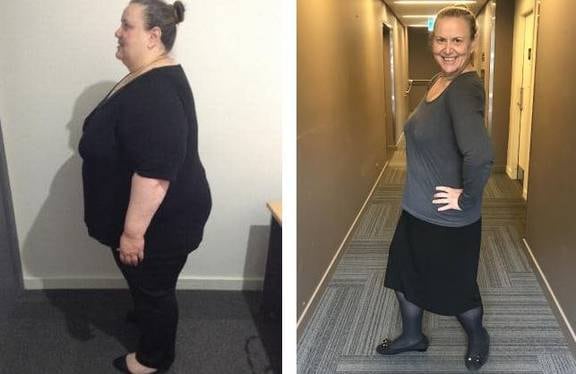 Woman's amazing 100kg weight loss in 11-months - NZ Herald