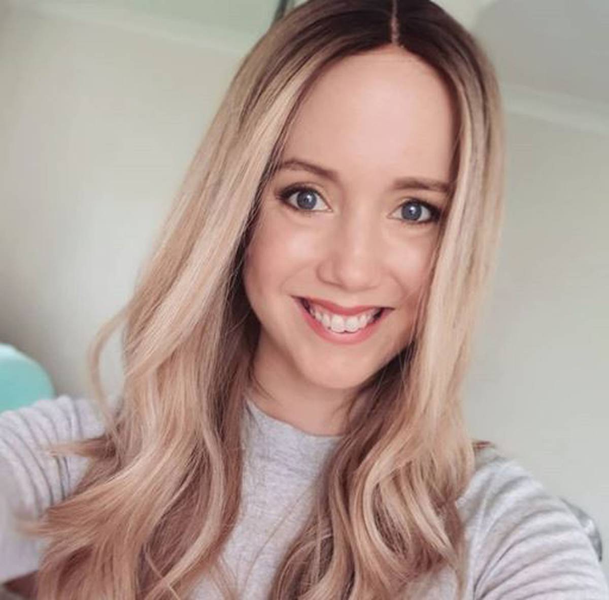 Woman loses 50 per cent of hair after changing her contraceptive