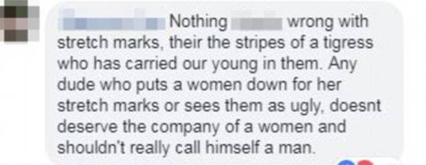 One woman said stretch marks are the stripes of a tiger who has carried their young. Photo / Facebook