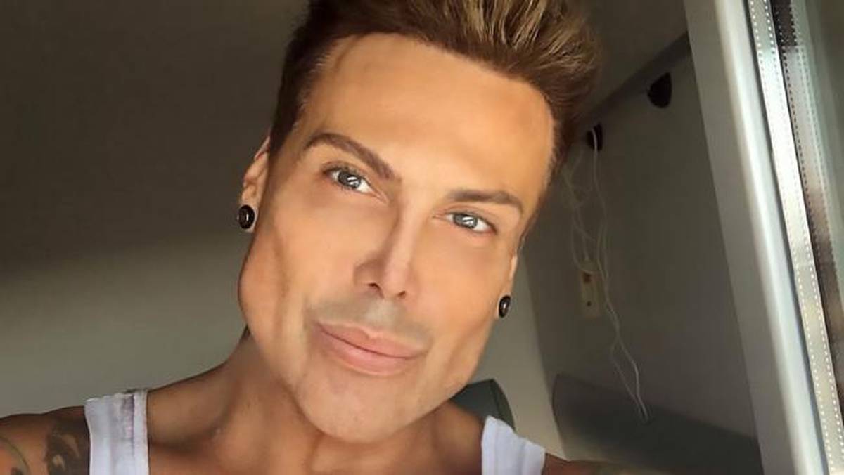 Plastic Surgery Addict Left With Permanent Erection After Botched