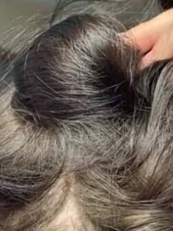 Woman's horror hair loss after Pantene conditioner tampered with - NZ Herald