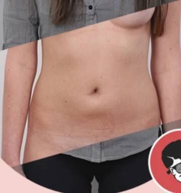 deep nude photo