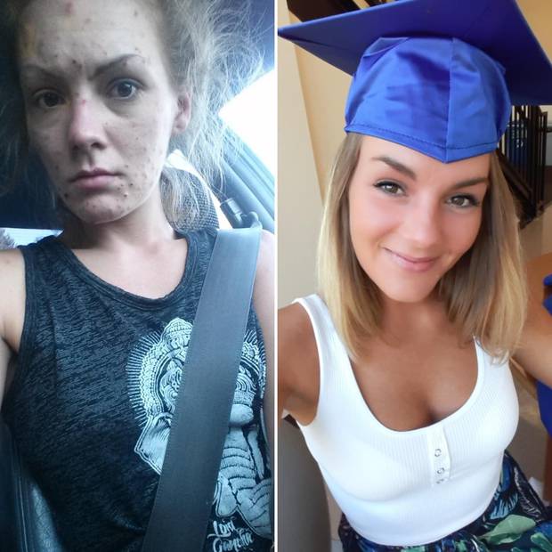 Former Meth Addict Shows Off Her Amazing Transformation With Photos Nz Herald