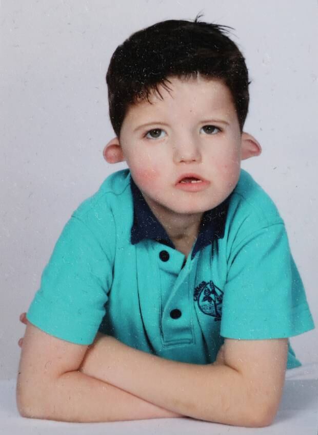 Up until April this year Auckland boy Charlie Kiefte (10) could not smile. Photo / Supplied