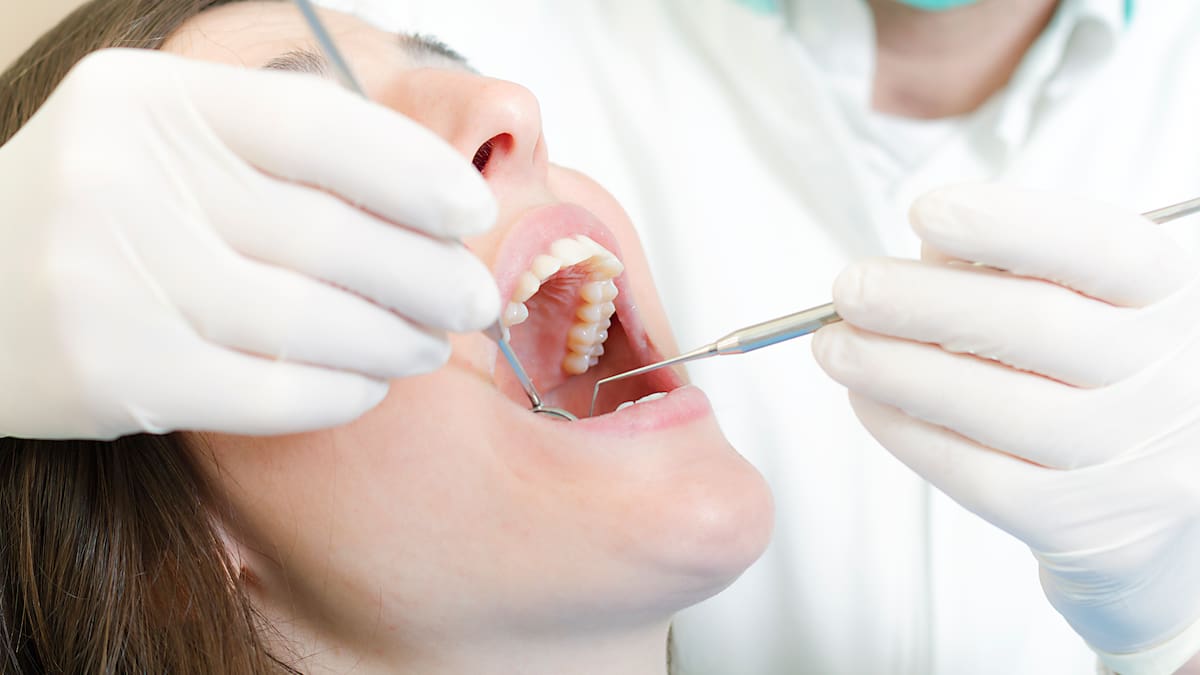 Alarming Rise in Adult Tooth Decay: Aussie Dentists Demand Urgent Action