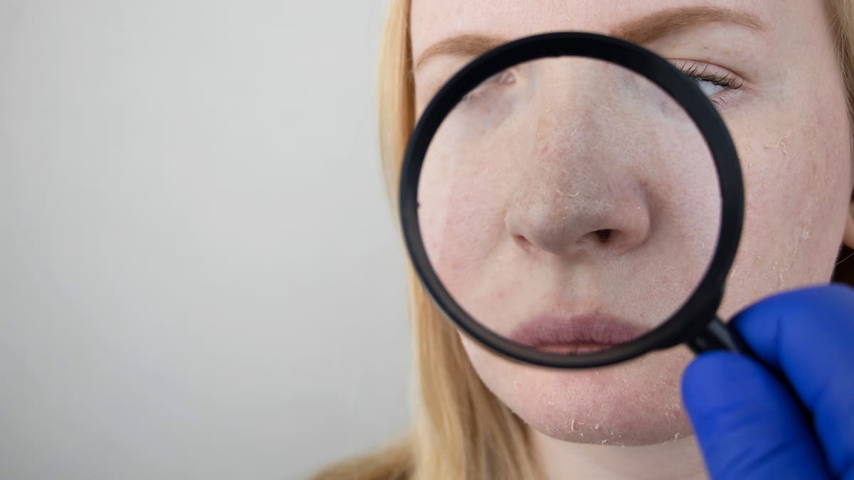 Woman says she was left with collapsing nostril after being ‘upsold’ unnecessary surgery Woman says she was left with collapsing nostril after being ‘upsold’ unnecessary surgery