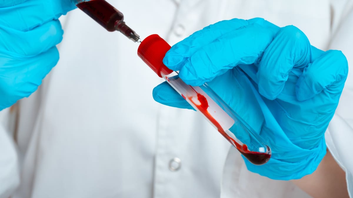 Medical Technician Loses Registration for CV Fraud Medical Technician Loses Registration for CV Fraud
