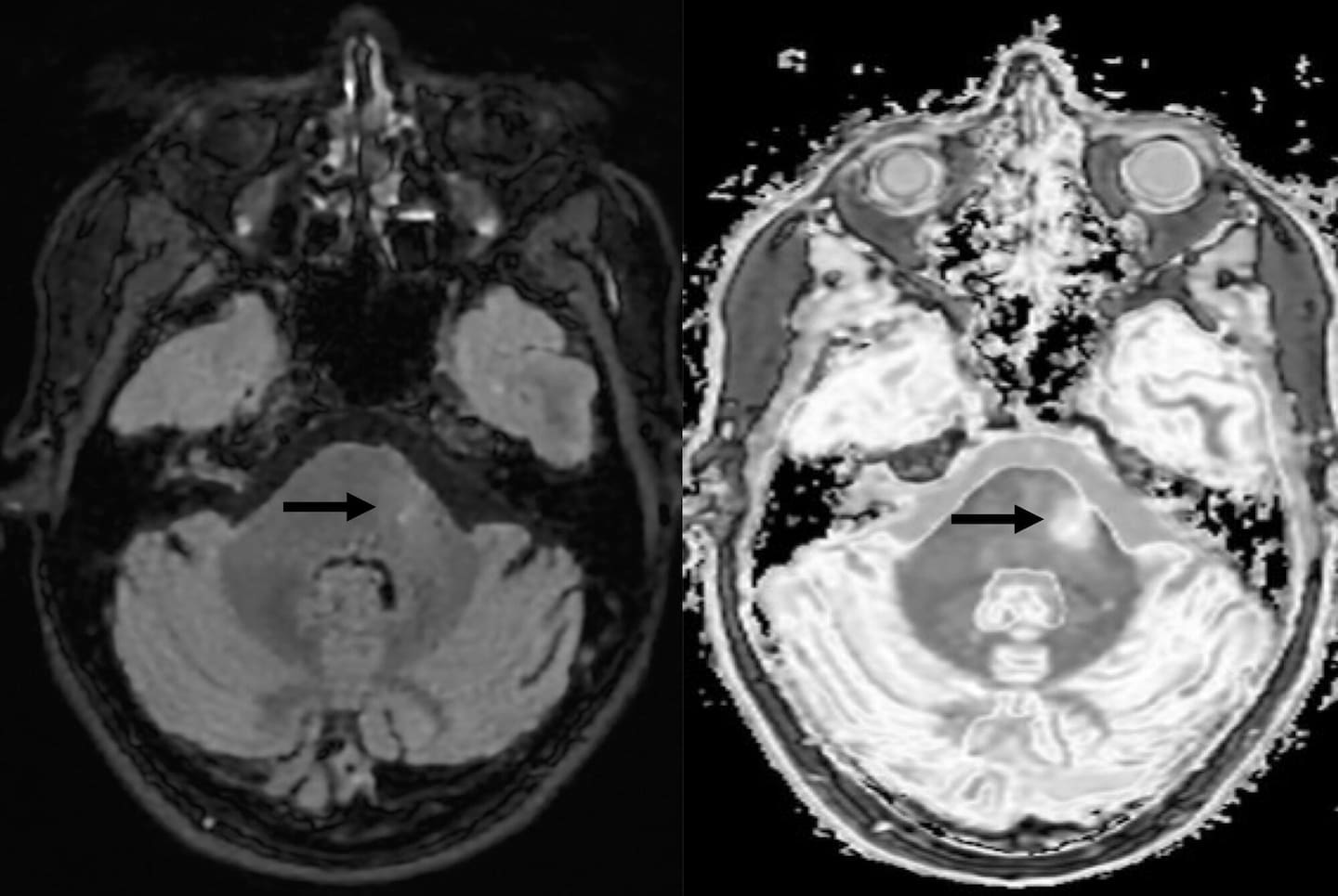 On The Up: Mātai researchers developing new MRI method with better ...
