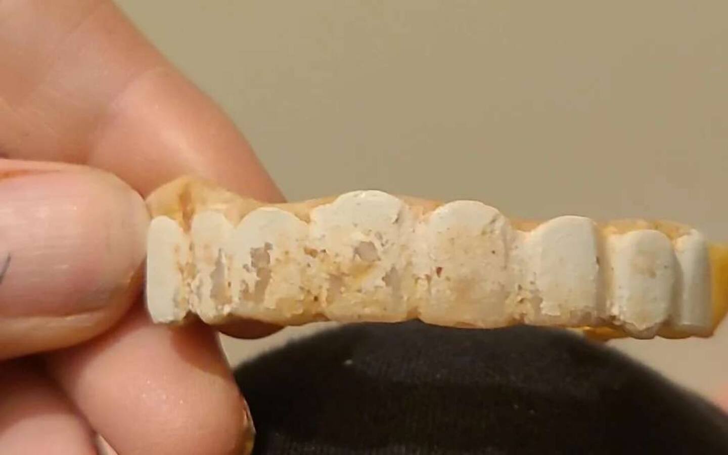 Abuse victim Ellie has made her own "teeth" out of melted beads and fake nails. Photo / Supplied via RNZ