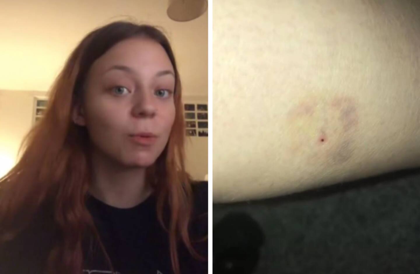 Shocking clip shows worrying spiking injection 'epidemic' sweeping UK ...