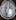 Amelia Branson's MRI scan of her brain tumour when she was diagnosed in September 2021 – she said the white area was swelling and the ball-looking part was the tumour.