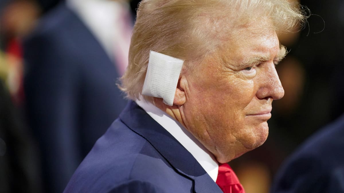 FBI says a bullet — or bullet fragment — hit Trump FBI says a bullet — or bullet fragment — hit Trump