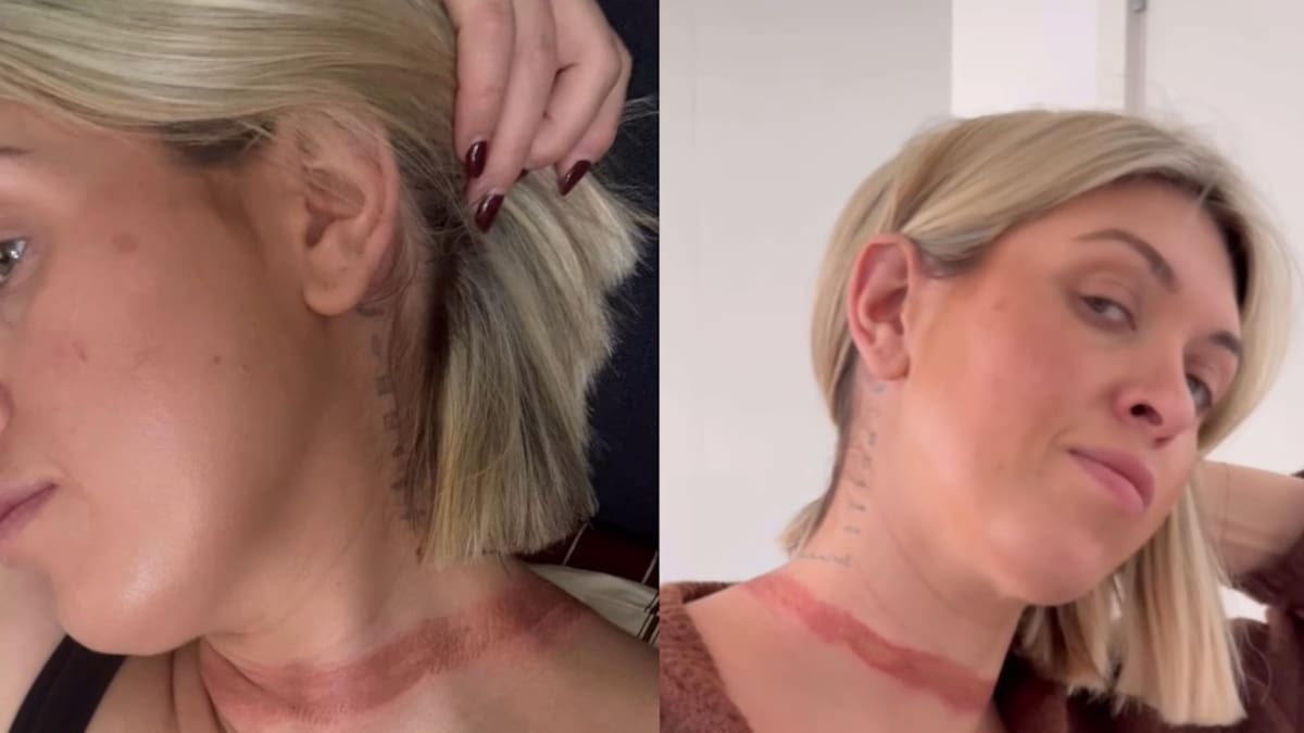 Australian influencer Eli Moulton ‘nearly decapitated’ in freak wardrobe malfunction with scarf and BMW