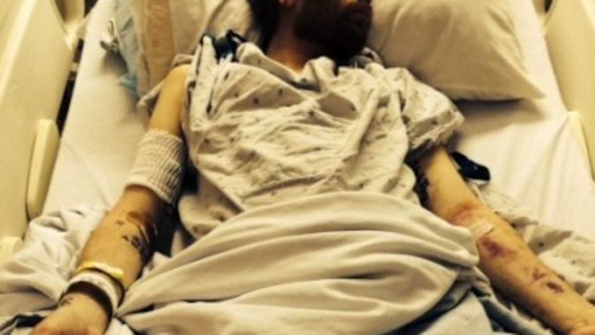 Sick rocker admits spending $1700 a week on alcohol - NZ Herald