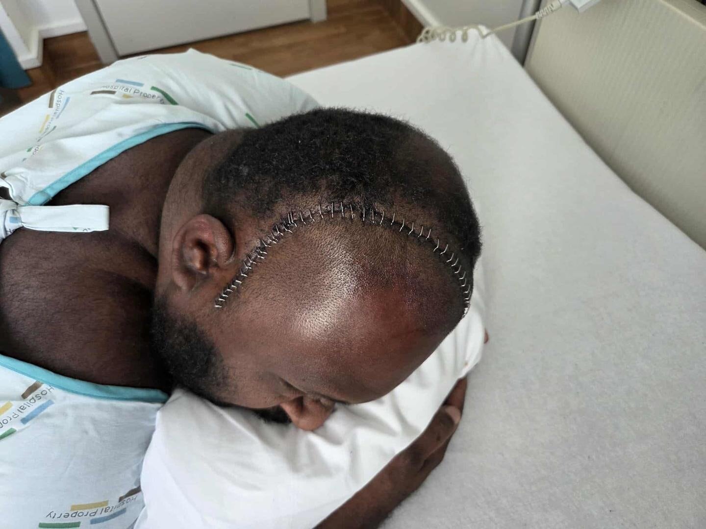  Bob underwent surgery in an effort to remove as much of the brain tumour as safely possible. Photo / Supplied