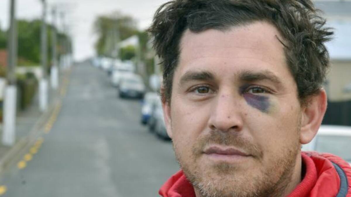 Dunedin man attacked in alleged road rage incident frustrated at ...