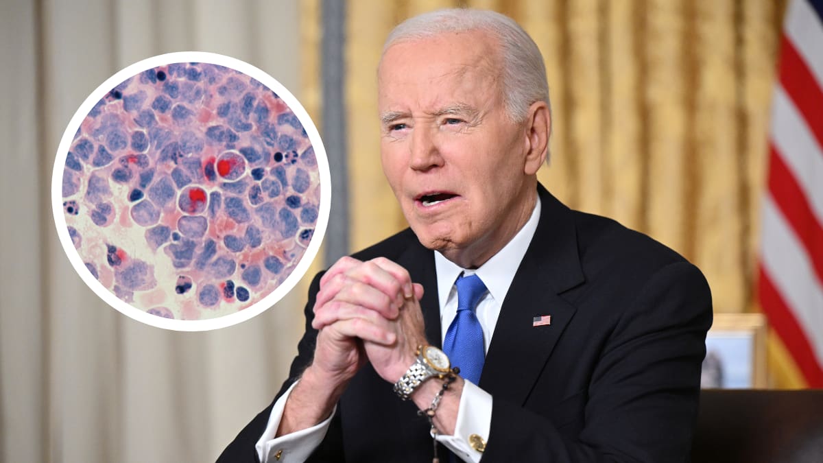 Joe Biden’s ‘aggressive’ prostate cancer diagnosis explained Joe Biden’s ‘aggressive’ prostate cancer diagnosis explained