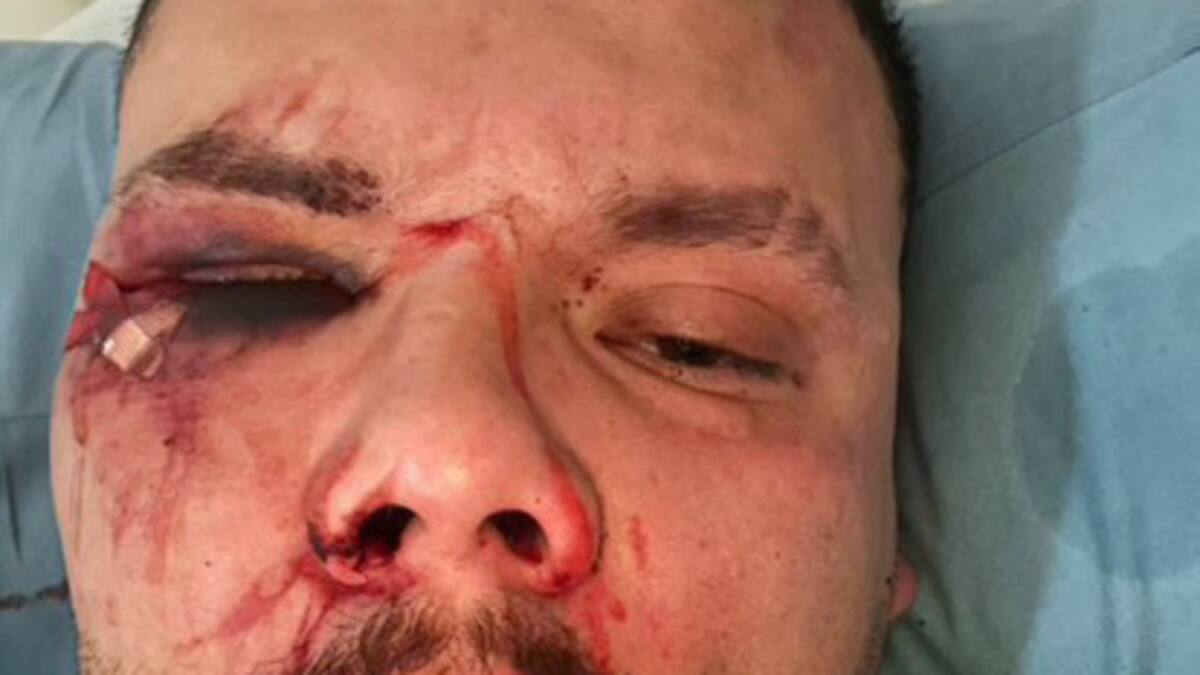 Man hospitalised after violent ‘hate crime’ at Central Auckland gay bar Man hospitalised after violent ‘hate crime’ at Central Auckland gay bar