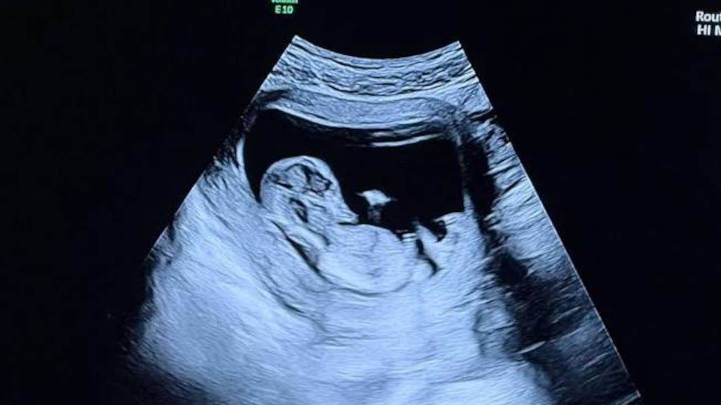 Pete Davidson Thrilled About Upcoming Fatherhood Journey, Sources Say