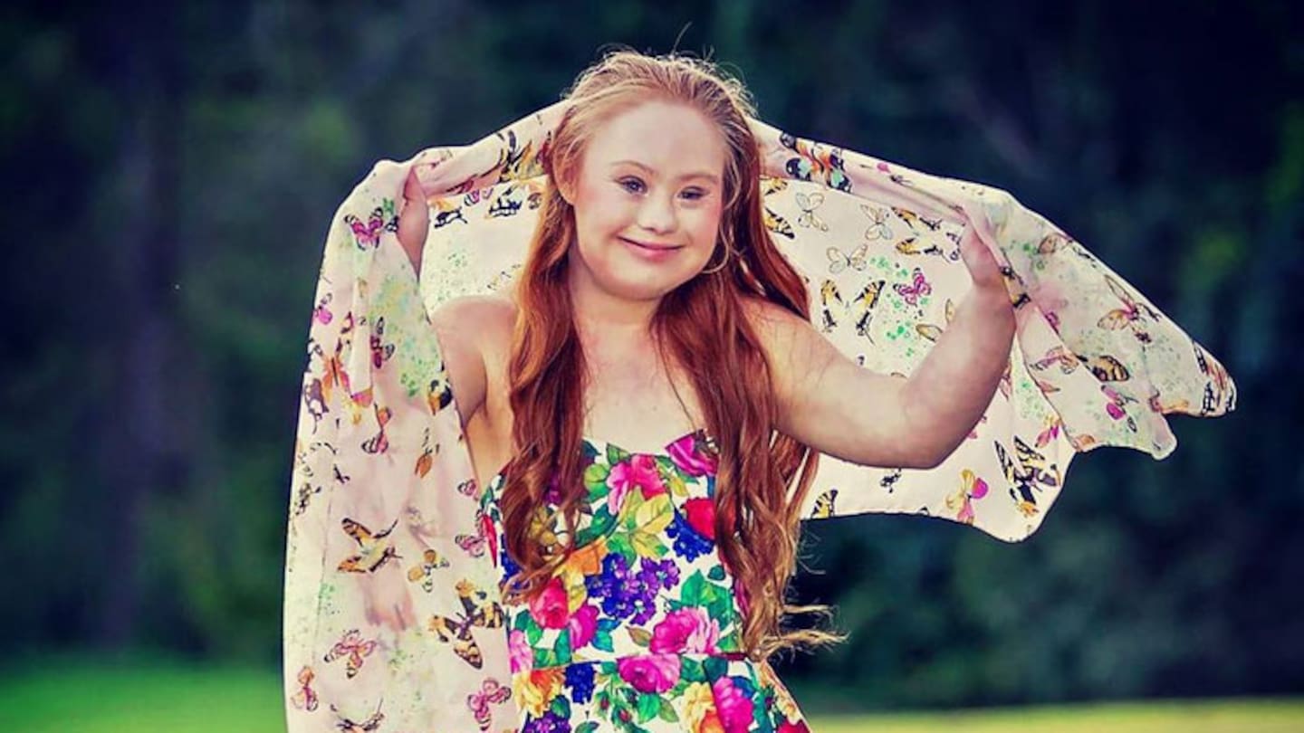Teen with Down syndrome 'changing the face of modelling ...