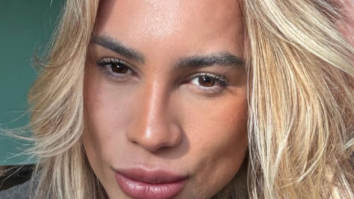 ‘Fox-eye’ surgery under scrutiny after influencer’s death in Brazil