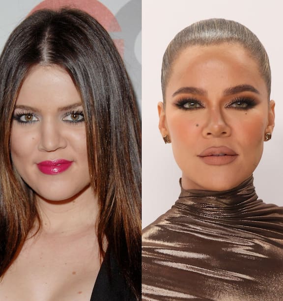 Khloe Kardashian reveals why she 'doesn't miss her old face' amid criticism  - NZ Herald