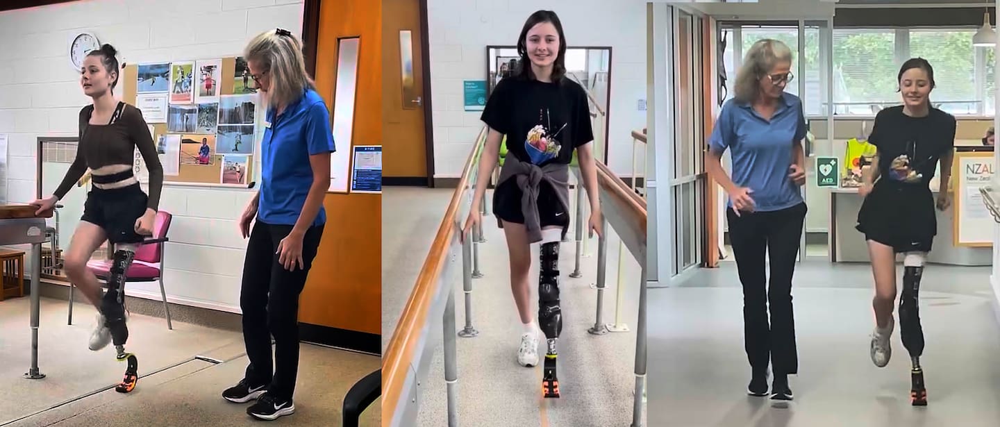 Annabel Knight lost a knee and part of her leg to cancer but a innovative surgery means she can use a prosthetic and remains upbeat and active.  Photo / Supplied