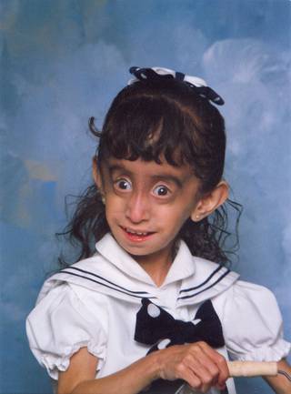 'Online bullies called me the world's ugliest woman' - Lizzie Velasquez